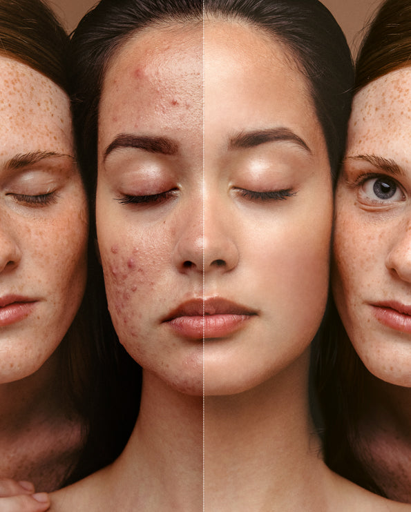 F84 Blemish Control Face Mask